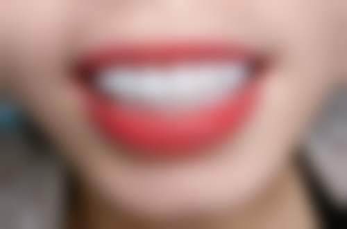 深圳广安康口腔门诊部顾客实例