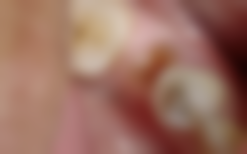 文昌云天耀口腔诊所怎么挂号，地址在哪儿