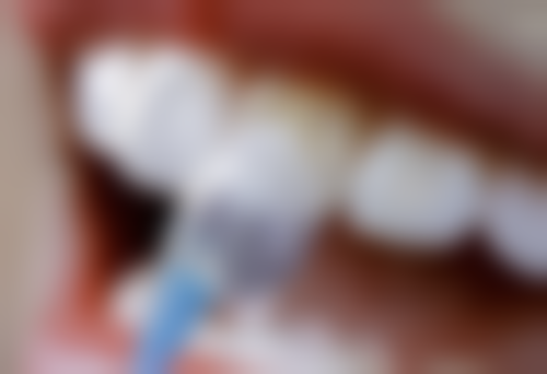 种植牙美国进口和韩国进口种植牙品牌特色解读：各有哪些“明星选手”？