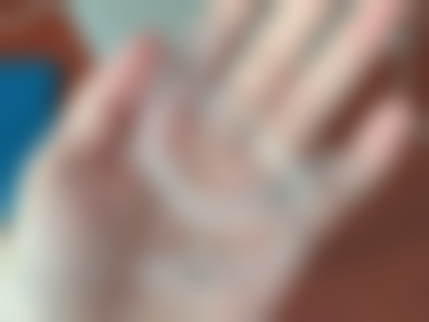 张明月医生项目优势