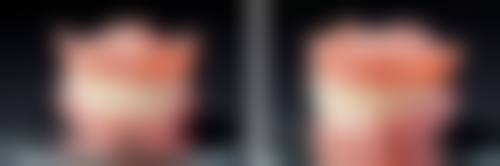 宋昊医生做手术价格