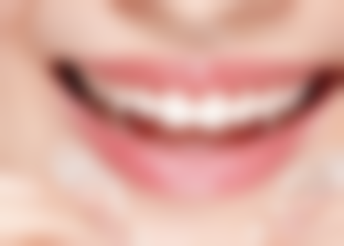 种植牙二期到安装牙冠需要多久之种植牙二期后的注意事项