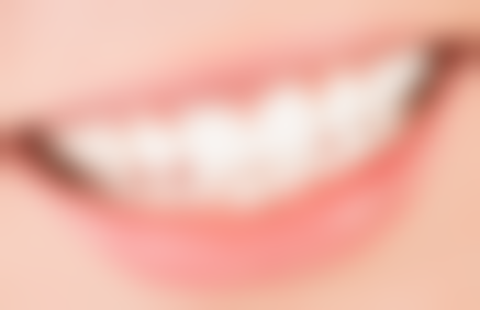 吉林松原市前郭县瑞博口腔抖音团购活动有哪些，价格表如何？