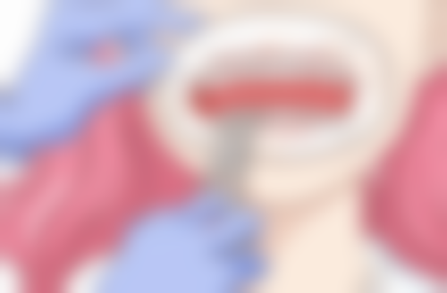 种植牙做临时牙冠之容貌提升优势