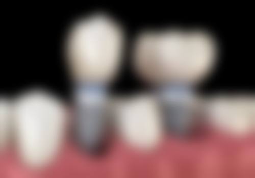 荣信口腔诊所怎么样，价格表