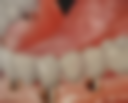 许国雄医生简介做手术价格