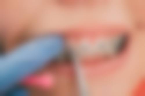 广州柏德口腔门诊部王丽艳团队专精实力