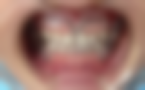 60岁种植牙的医院与医生选择指南之如何选择靠谱医院:60岁种牙怎样选靠谱医院?