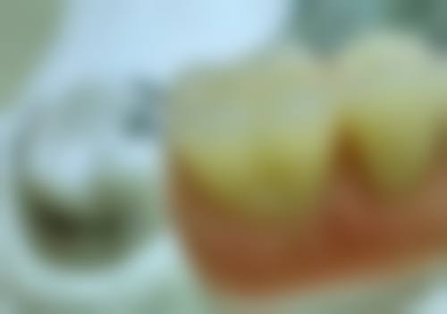 张敏医生：心律失常治疗骨干医生