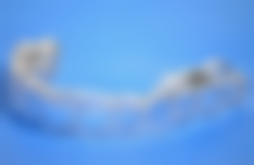 活动义齿和种植牙有什么区别——稳定性较量：摇摇欲坠VS稳如泰山