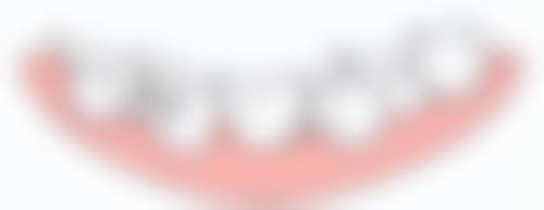 韩国登腾的种植牙怎么样之质量稳定：科技赋能的坚固“牙齿地基”