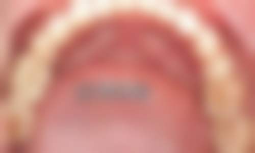 杭州达仑口腔门诊口碑好不好？