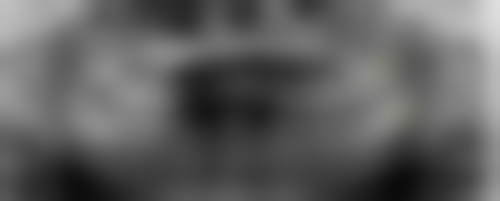 北京京大博爱口腔门诊部刘婧手术成功几率——北京佳美口腔医院