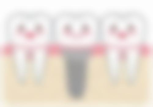 江苏苏州优乐仕口腔抖音团购活动有哪些，价格表