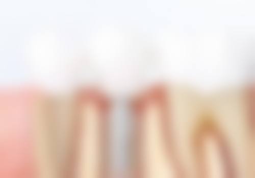 刘祥文医生简介做手术价格