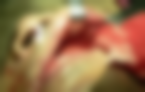 济宁遇见牙博仕口腔门诊部顾客实例