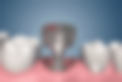 丽水莲都旭勇口腔诊所更擅长什么