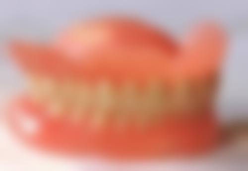 四、16岁做种植牙的费用:从几千到上万元的预算指南