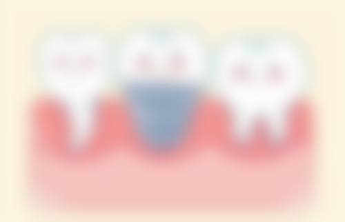 桂林爱牙口腔专科门诊部顾客实例