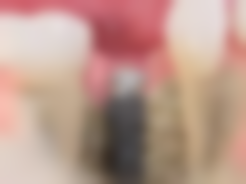 广州柏德口腔门诊部沙赫拉姆·沙姆斯瓦利双博士学位在种植牙领域有何优势