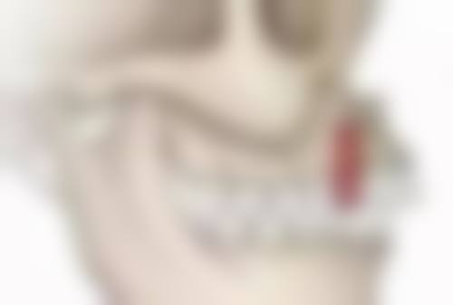 韩国种植牙品牌之登腾（Dentium）：小而美的种植之星