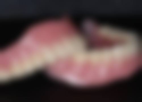 70岁老人能种植牙吗?之牙槽骨条件评估