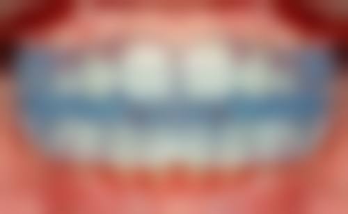 林茜医生简介：挂号方式