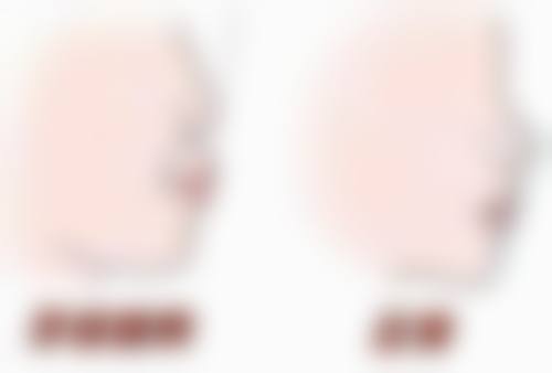 丁佳宁医生简介口碑如何