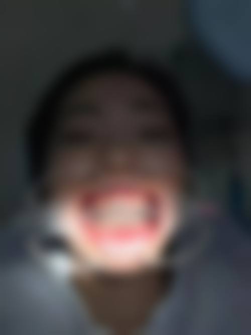 广州康湖牙科正规吗