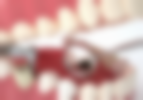 80岁有高血压还能种植牙吗?血压控制是关键防线