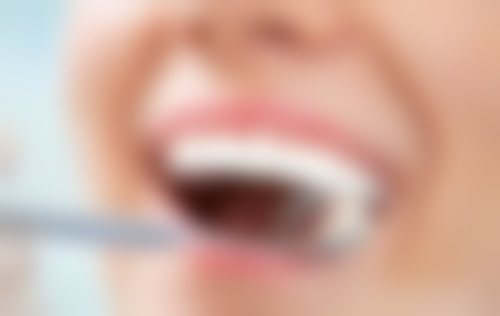 美国高端品牌种植牙的优势与适用人群