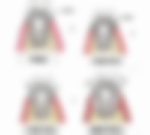 半口种植牙不同技术的完成时间对比