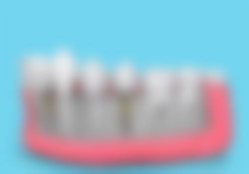 郑州小天鹅口腔医院崔复胜的技术好不好——郑州小天鹅口腔医院