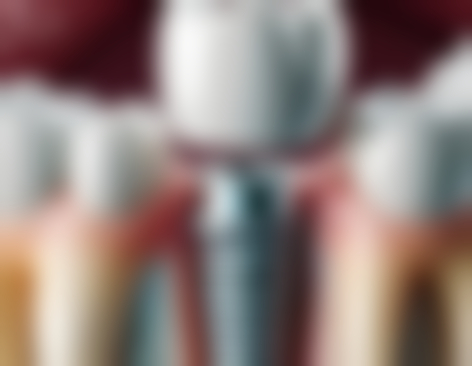 巴中自强时代口腔诊所更擅长什么