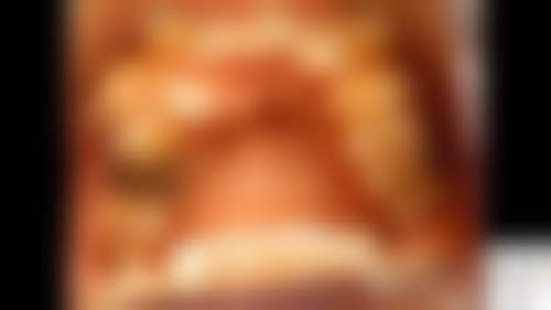 义乌惠众口腔口碑好不好