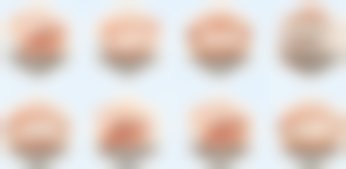 根管牙和种植牙有什么区别?适用人群大筛选