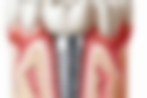 北京京大博爱口腔门诊部叶丽萍更擅长做什么项目——郑州美莱医疗美容医院