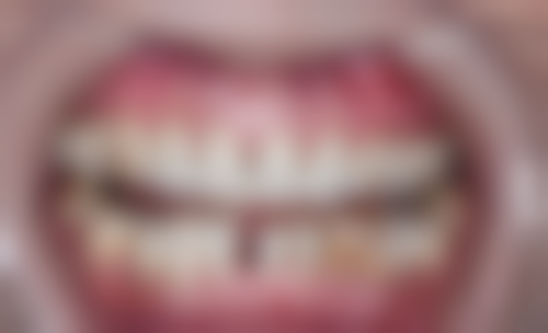 何义医生项目优势