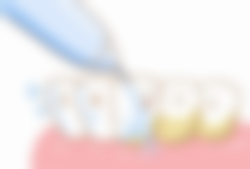 老年人种植牙：年龄非阻，健康状况定乾坤