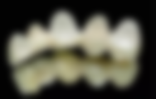 王云飞医生简介项目优势