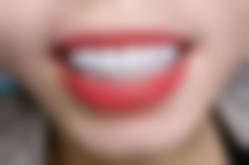 山东临沂兰山王娟口腔怎么样？特色项目