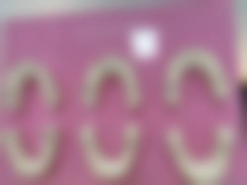 山东临沂兰山王娟口腔怎么样？口碑好不好