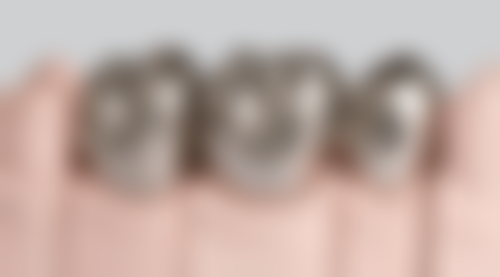 曾月医生简介做手术价格