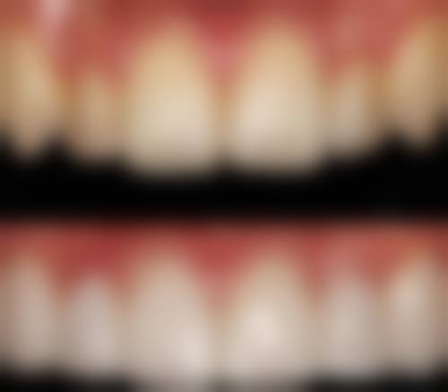 许国雄医生简介：项目优势