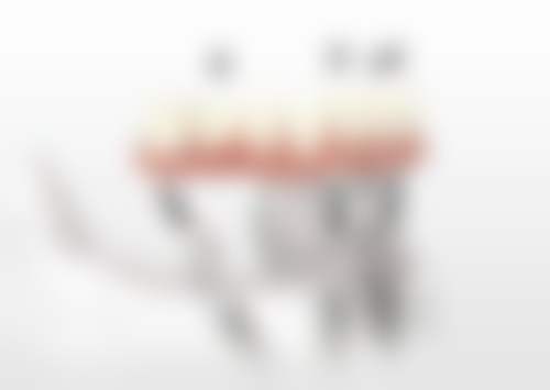 山西大同合美口腔门诊部顾客实例