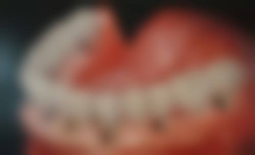 河源惠建军口腔诊所怎么挂号，地址在哪儿