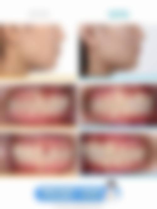 重庆天程口腔门诊部怎么样，顾客实例有哪些