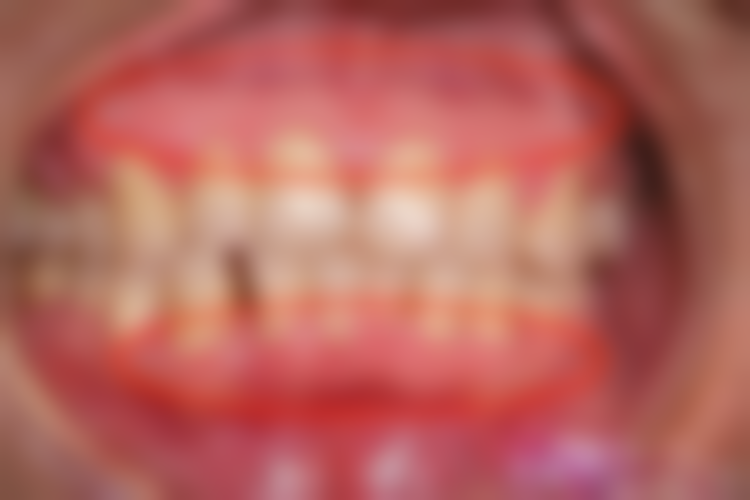 刘会医生口碑如何