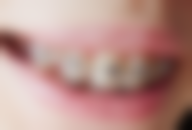 徐州美奥口腔医院口碑评价