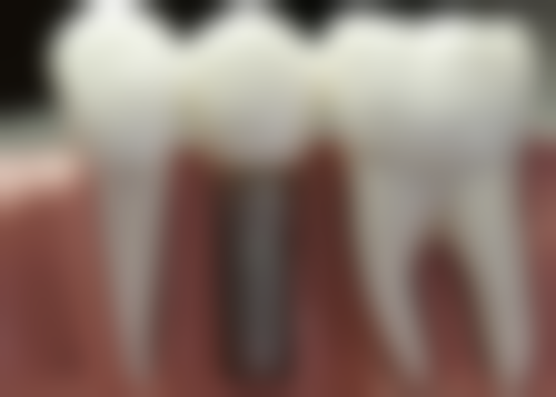 宁波诺心口腔的口碑好不好